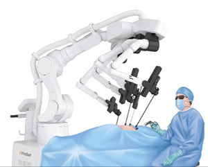 手術支援ロボット